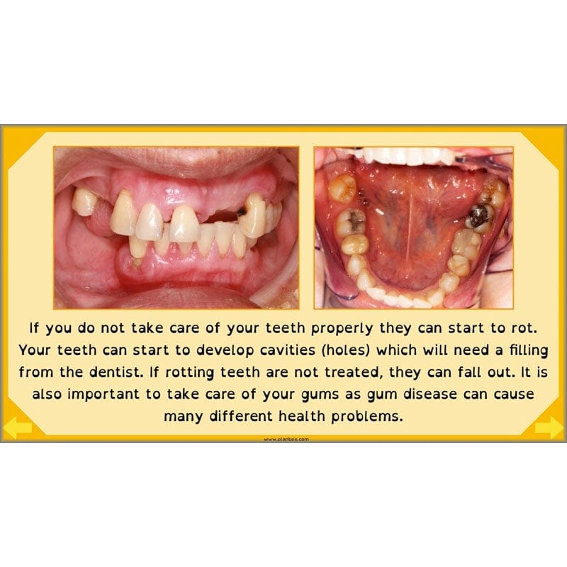 PlanBee Digestive System Year 4 Animals including Humans | PlanBee